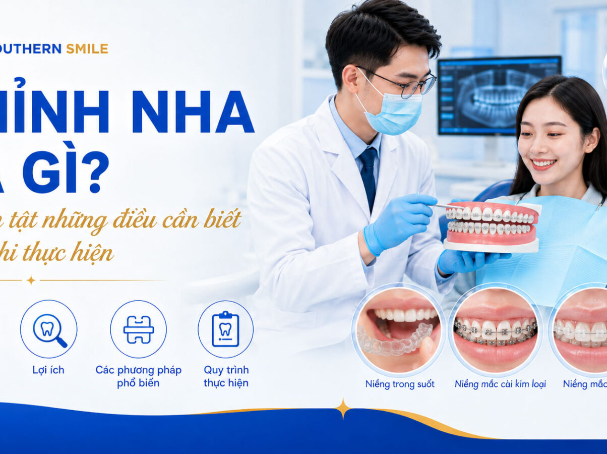 chinh-nha-la-gi-final