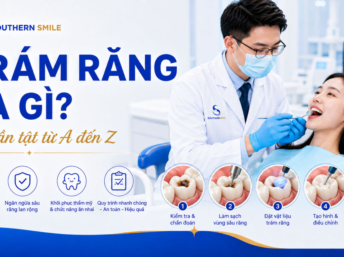 tram-rang-la-gi-final