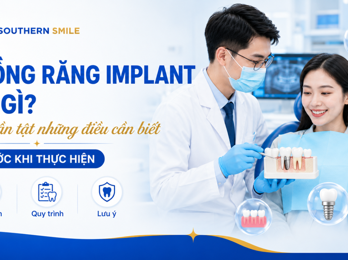 trong-rang-implant-la-gi-hinh-final